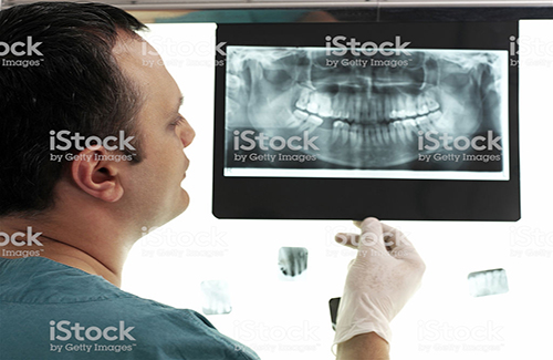 dentist looking x-ray